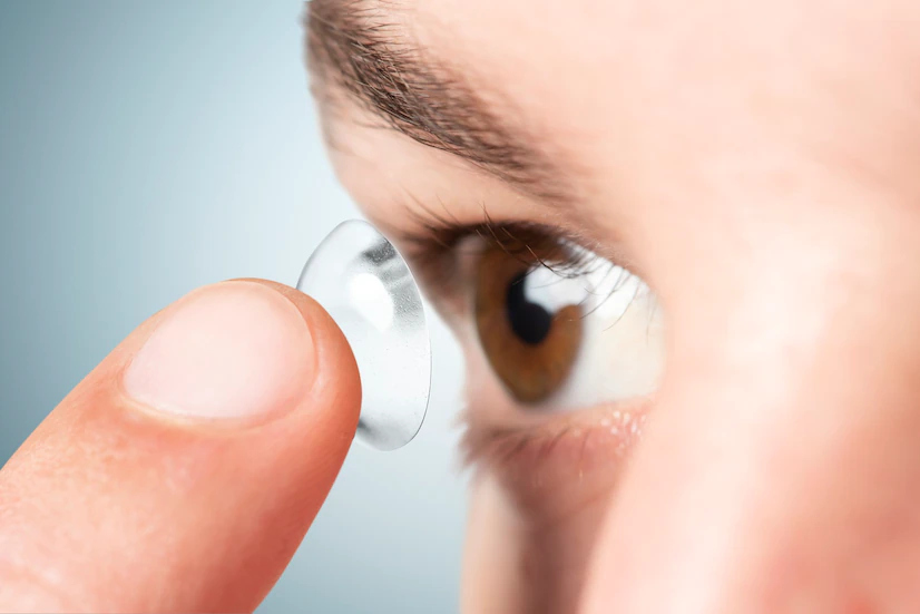 What are Contact Lenses?